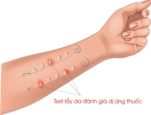 Kết quả test da