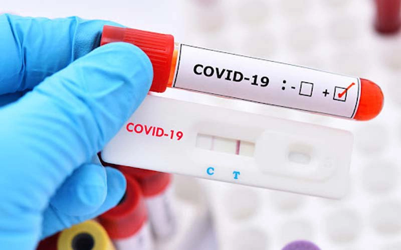 Test covid 2 vạch mờ