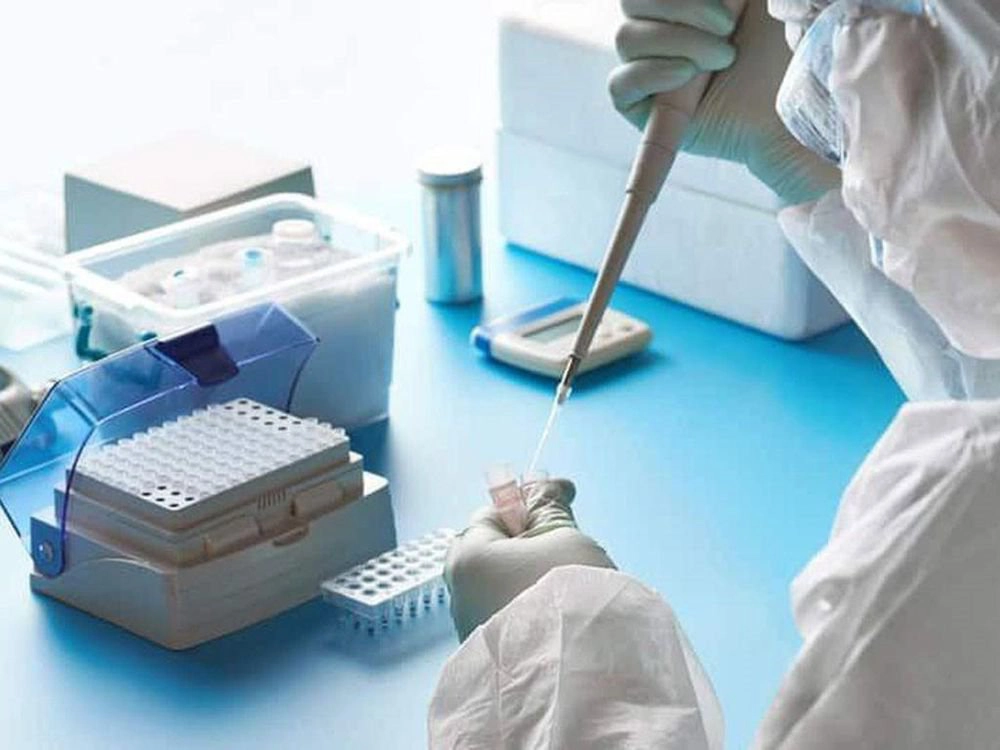 Kết quả test PCR CT 28 đã khỏi Covid chưa?