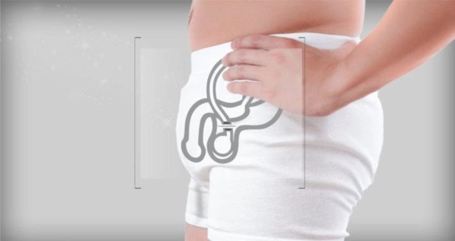 Thắt ống dẫn tinh có ảnh hưởng gì không