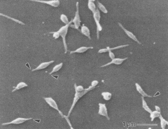Mycoplasma pneumoniae