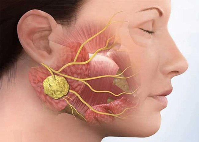 nổi cục u sau đầu