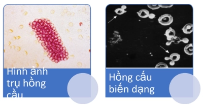 Nguồn gốc tiểu máu