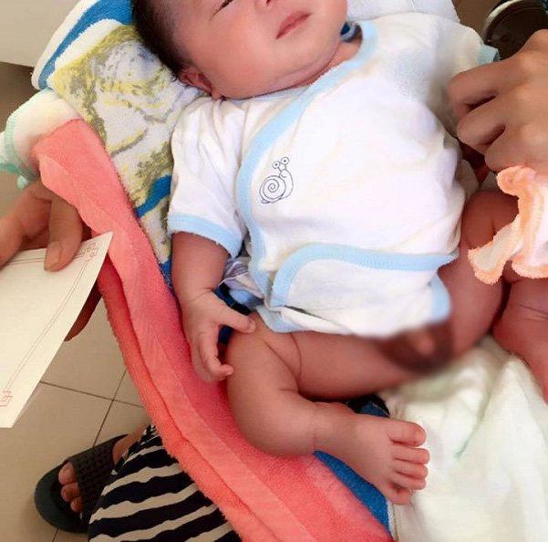 Xương thủy tinh