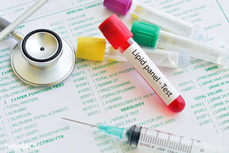 lipid test