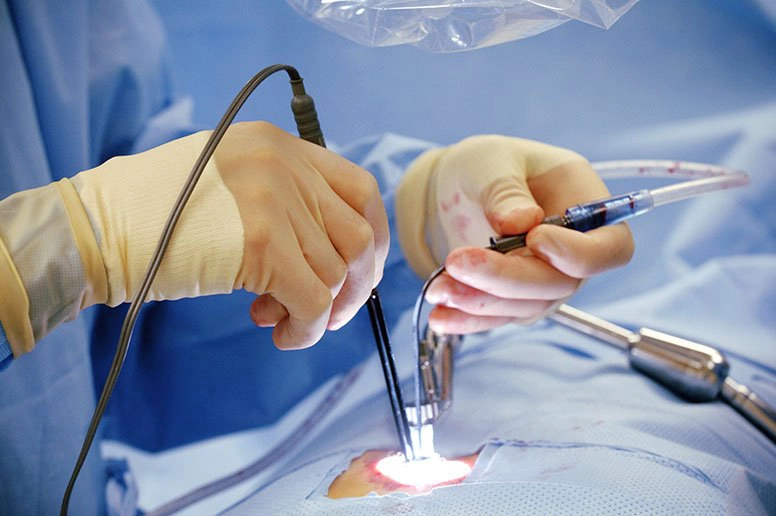 Phẫu thuật nội soi lồng ngực điều trị nhão cơ hoành