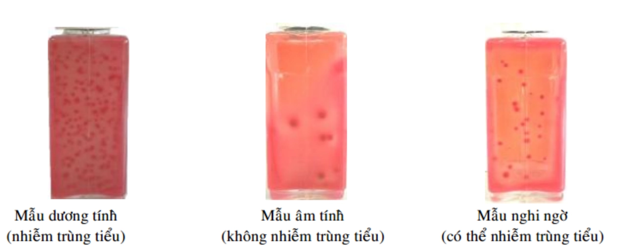 Nuôi cấy nước tiểu