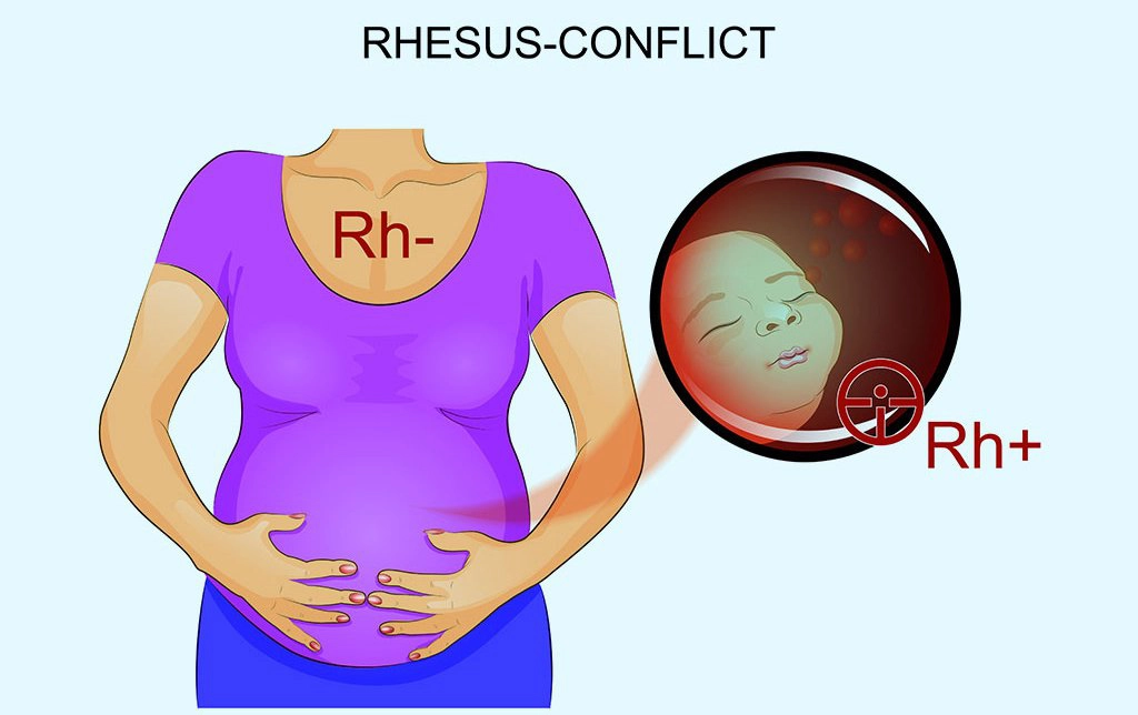 rh âm tính là gì