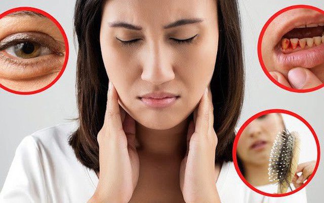 Những dấu hiệu điển hình cho thấy cơ thể đang thiếu biotin