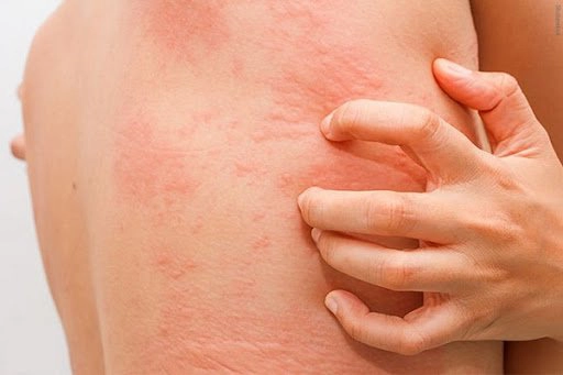 Trẻ đi ngoài ra máu khi nào nguy hiểm?