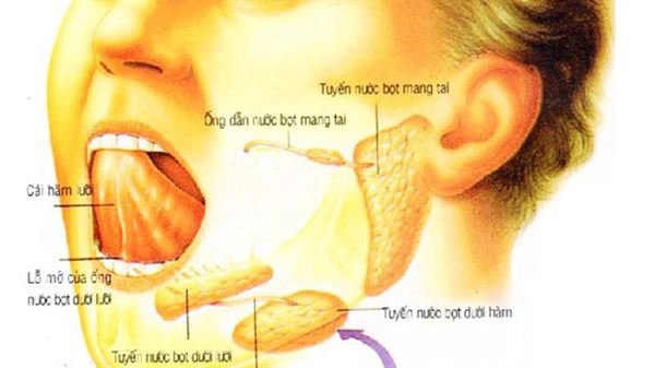 ung thư tuyến nước bọt