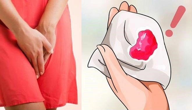 Nguyên nhân gây băng huyết sau sinh