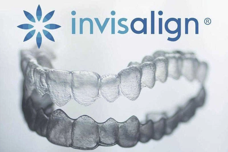 Niềng răng trong suốt Invisalign