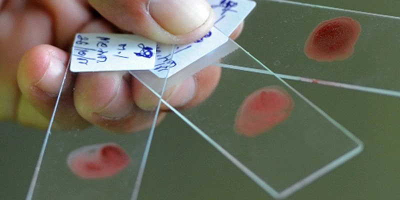 xét nghiệm sốt rét