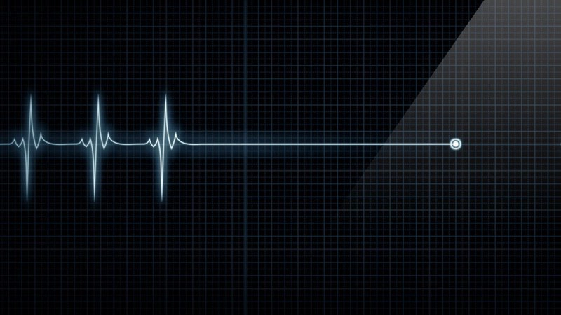 Bệnh nhân có thể bị ngừng tim khi gây mê nội khí quản