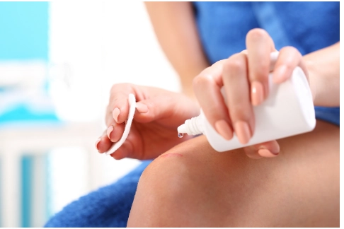 Sau khi cắt chỉ nên chăm sóc vết thương như thế nào?