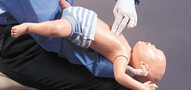 Vỗ lưng và ép ngực