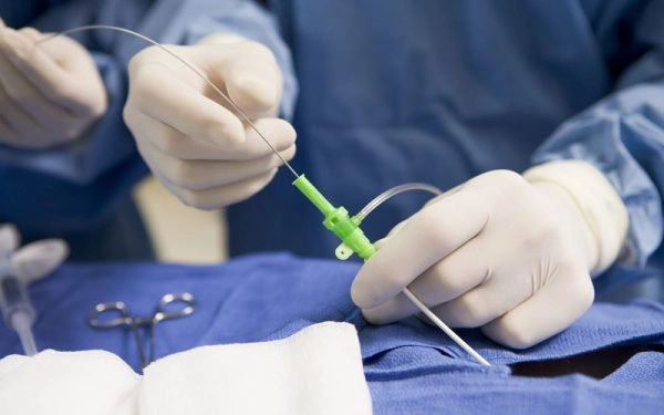 Phương pháp đốt điện điều trị viêm lộ tuyến cổ tử cung