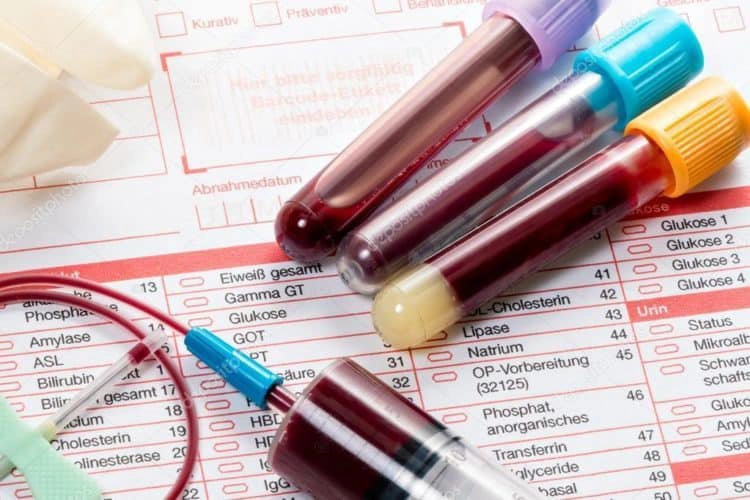 Xét nghiệm máu có phát hiện nghiện ma túy không