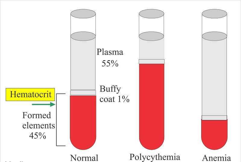 Xét nghiệm Hematocrit nhằm chẩn đoán các rối loạn về máu