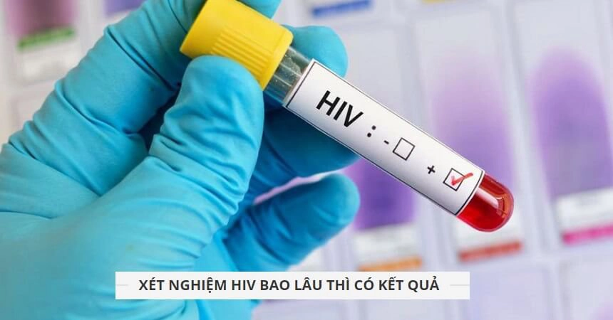 HIV