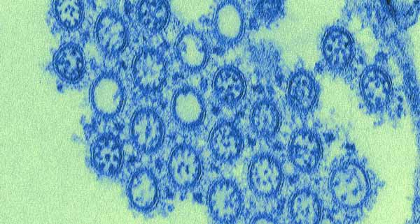 Virus cúm A (H1N1) pdm09