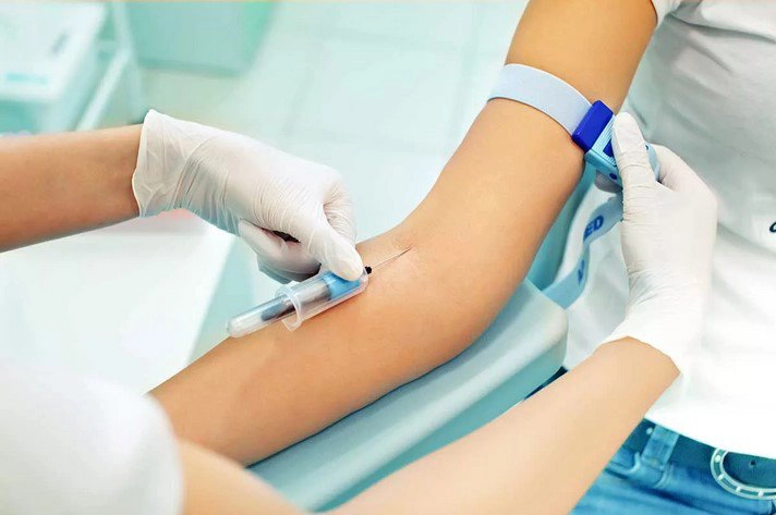 Xét nghiệm sốt xuất huyết bao nhiêu tiền