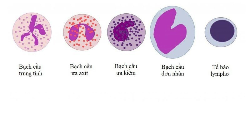 Bệnh bạch cầu đơn nhân