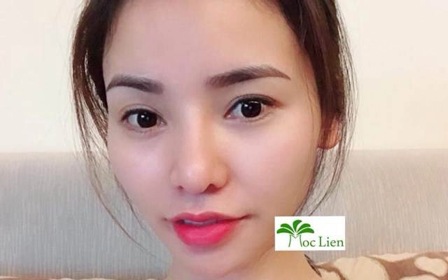 Thẩm Mỹ Mộc Liên