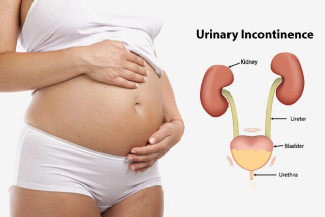 Bà bầu 16 tuần bị sỏi thận nên đi khám không?