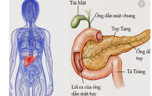 Bạn có thể sống mà không có tuyến tụy hay không?