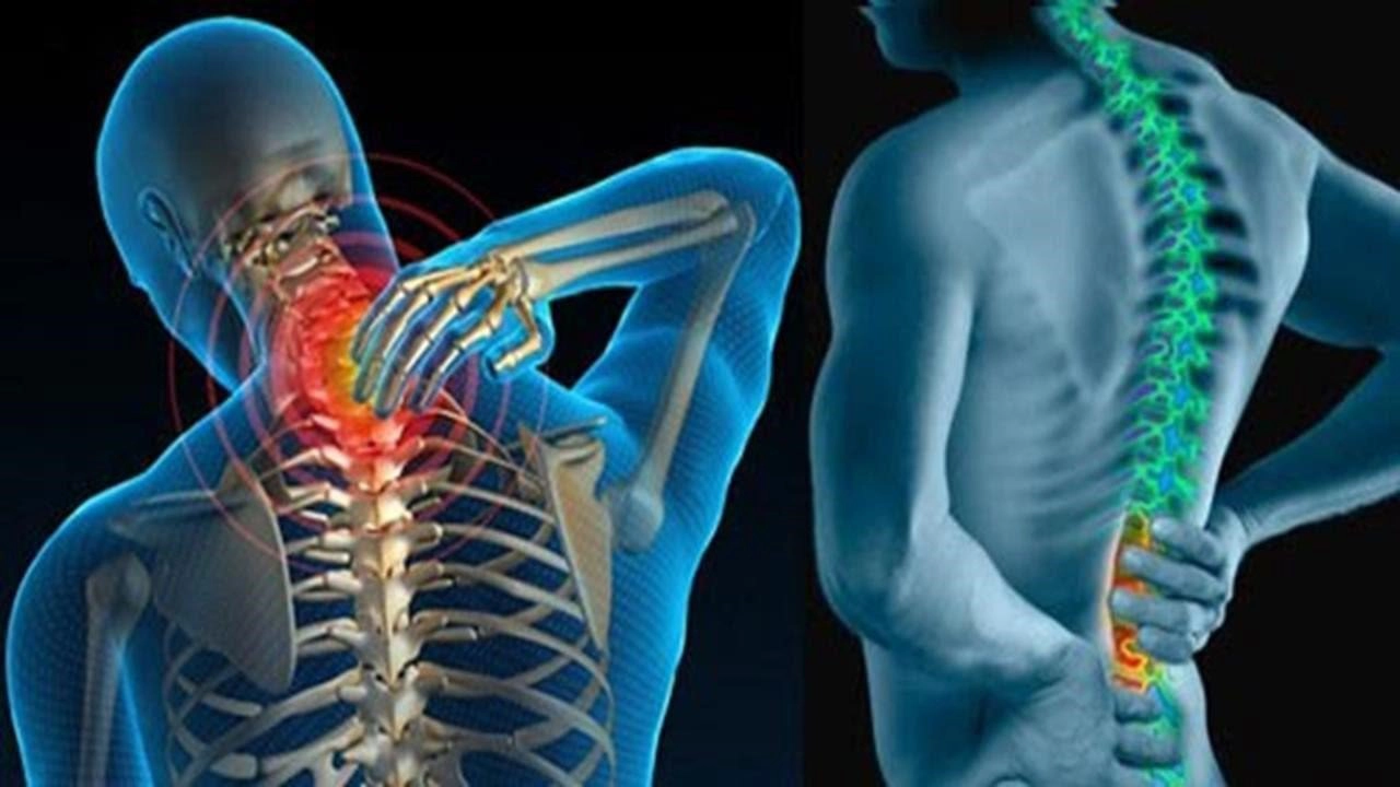 Bệnh gai cột sống có chữa được không?