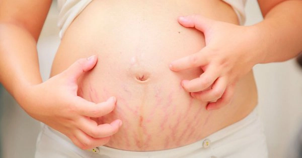 Bị dị ứng thực phẩm khi mang thai: Khi nào nguy hiểm?
