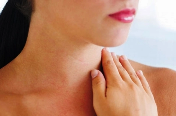Bướu cổ giai đoạn đầu có dễ nhận diện?