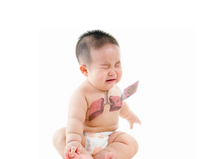 Các biểu hiện nặng của bệnh viêm phổi ở trẻ em