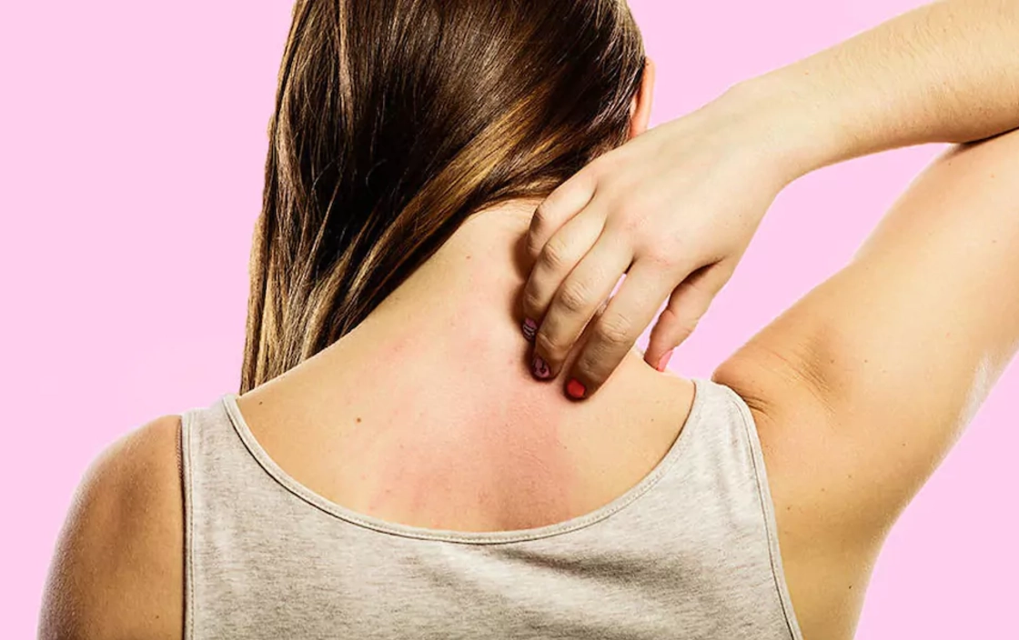 Các dấu hiệu dị ứng nghiêm trọng