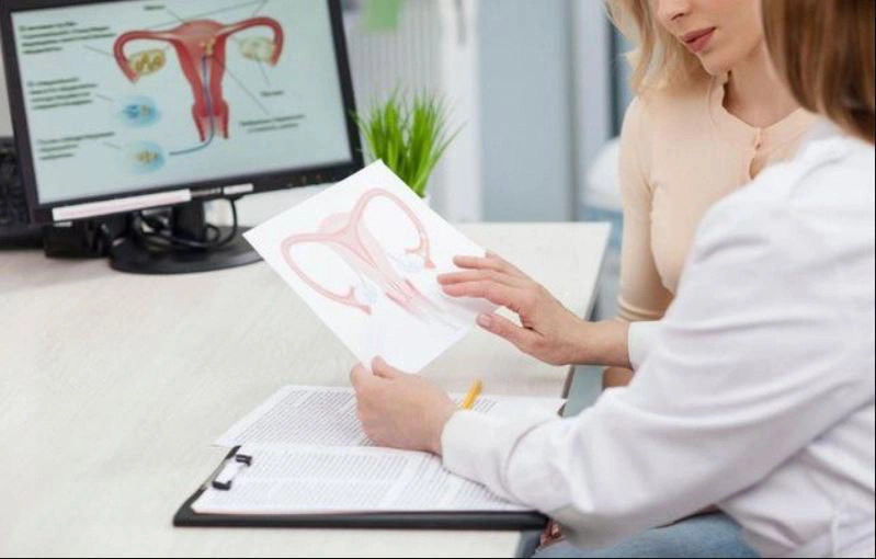 Các điểm cần lưu ý khi điều trị u nang buồng trứng