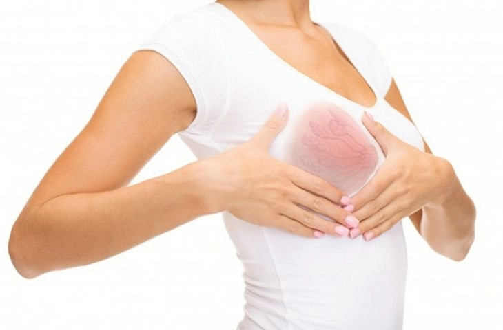 Cách chữa tắc tia sữa nổi cục
