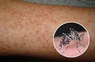 Cách phòng các bệnh thường gặp sau mưa bão