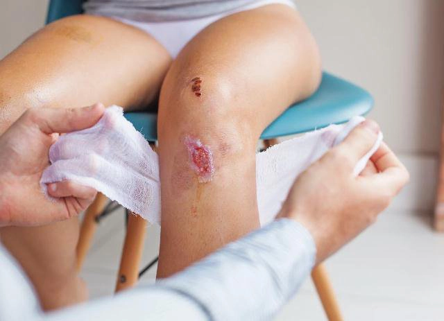 Cách rửa vết thương hoại tử