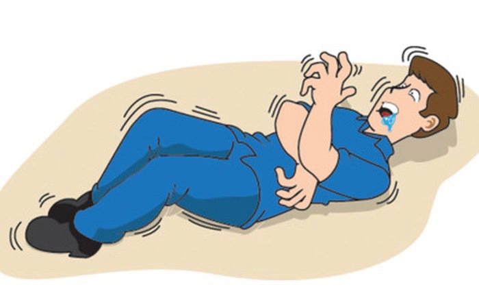 Cách sơ cứu người bị co giật
