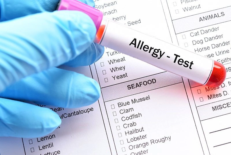 Cách test dị ứng đạm sữa bò cho trẻ