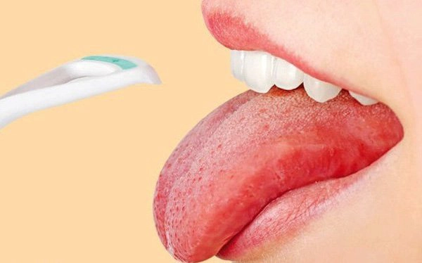 Cách trị lưỡi trắng ở người lớn