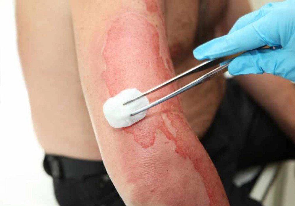 Cảnh giác bỏng và hạ thân nhiệt khi tắm cho trẻ sơ sinh mùa lạnh