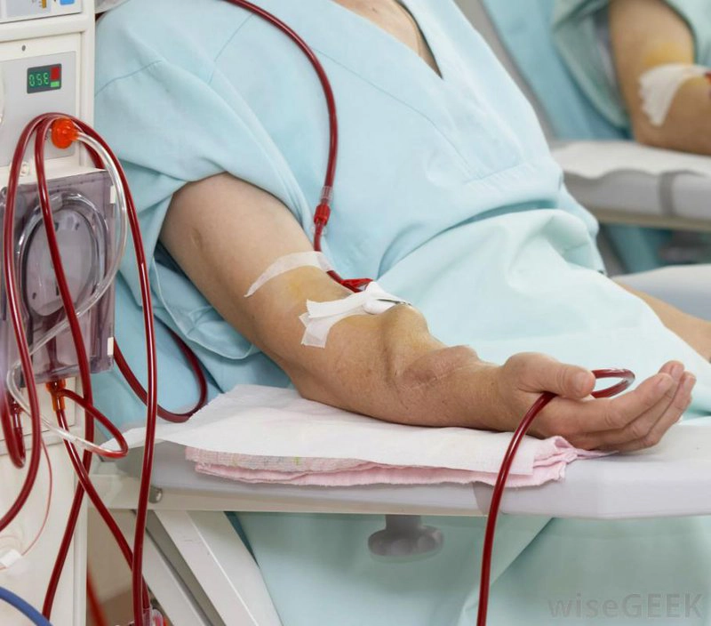 Cảnh giác nguy cơ tụt huyết áp khi chạy thận nhân tạo