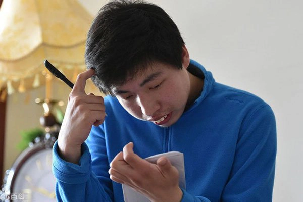 Chăm sóc người bệnh thiểu năng chậm phát triển