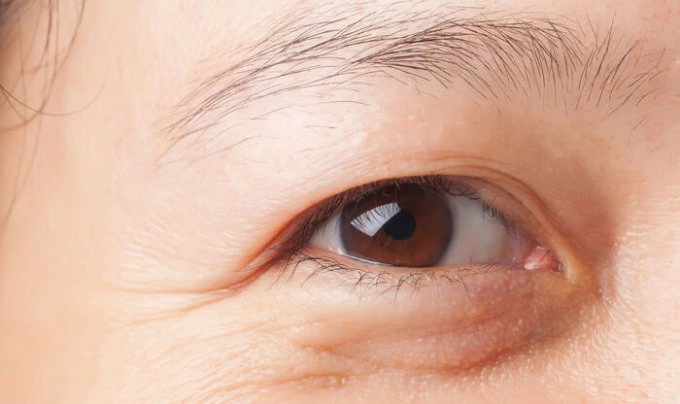 Chăm sóc vùng da quanh mắt bị lão hóa