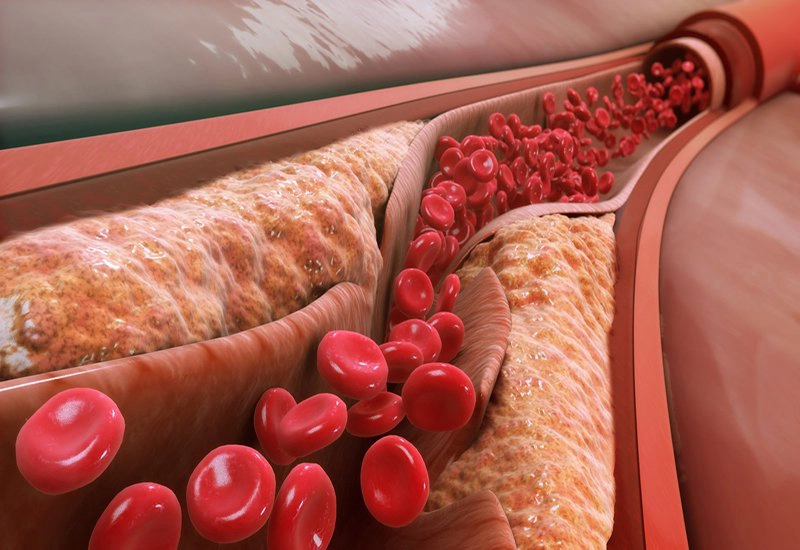 Chỉ số cholesterol toàn phần thấp có sao không?