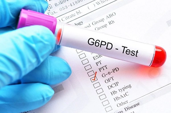 Chỉ số G6PD bao nhiêu là bình thường?