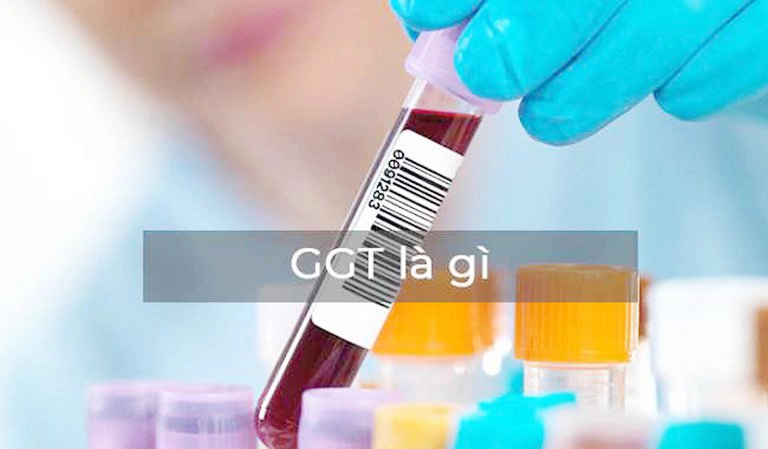 Chỉ số Gamma GT 165.00 tăng cao có sao không?